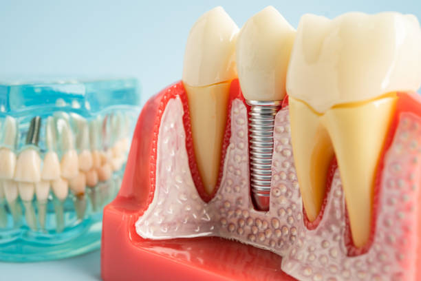 Oral Surgery in Edwardsville, KS